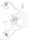 Fig. 08 - Positive-air-pressure machine conduit