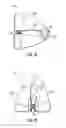 Fig. 03 - Catheter securement device with window