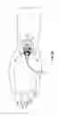 Fig. 04 - Catheter securement device with window