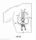 Fig. 06 - Catheter securement device with window