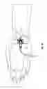 Fig. 08 - Catheter securement device with window
