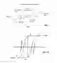 Fig. 06 - Thermally controlled variable-flexibility catheters and methods of manufacturing same