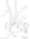 Fig. 02 - Catheter with a side port and methods for use thereof