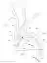 Fig. 04 - Catheter with a side port and methods for use thereof