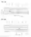 Fig. 04 - Balloon catheter