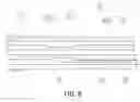 Fig. 09 - Balloon catheter
