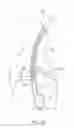Fig. 02 - Intra-esophageal balloon system