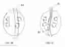 Fig. 03 - Intra-esophageal balloon system