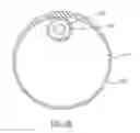 Fig. 18 - Intra-esophageal balloon system