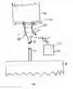 Fig. 02 - Aseptic or sterile connection system