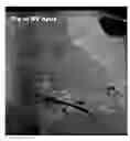 Fig. 01 - Detection of lead electrode dislodgement using cavitary electrogram