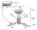 Fig. 01 - DIPOLE ELECTRICAL STIMULATION EMPLOYING DIRECT CURRENT FOR RECOVERY FROM SPINAL CORD INJURY