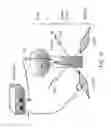Fig. 02 - DIPOLE ELECTRICAL STIMULATION EMPLOYING DIRECT CURRENT FOR RECOVERY FROM SPINAL CORD INJURY