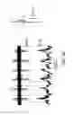 Fig. 08 - DIPOLE ELECTRICAL STIMULATION EMPLOYING DIRECT CURRENT FOR RECOVERY FROM SPINAL CORD INJURY