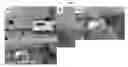 Fig. 01 - Intratumoral modulation therapy