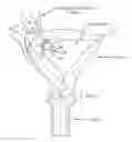 Fig. 01 - DEVICES, SYSTEMS, AND METHODS FOR TREATING OBSTETRIC AND GYNECOLOGICAL DISORDERS