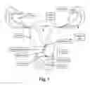Fig. 02 - DEVICES, SYSTEMS, AND METHODS FOR TREATING OBSTETRIC AND GYNECOLOGICAL DISORDERS