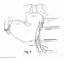Fig. 06 - DEVICES, SYSTEMS, AND METHODS FOR TREATING OBSTETRIC AND GYNECOLOGICAL DISORDERS