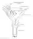 Fig. 09 - DEVICES, SYSTEMS, AND METHODS FOR TREATING OBSTETRIC AND GYNECOLOGICAL DISORDERS
