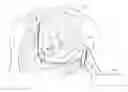 Fig. 01 - Confirming sensed atrial events for pacing during resynchronization therapy in a cardiac medical device and medical device system