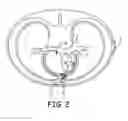 Fig. 03 - Confirming sensed atrial events for pacing during resynchronization therapy in a cardiac medical device and medical device system