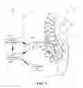 Fig. 02 - Complex variation of electrical stimulation therapy parameters