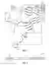 Fig. 02 - VARIATION OF SPATIAL PATTERNS IN TIME FOR COORDINATED RESET STIMULATION