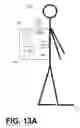 Fig. 11 - Wearable cardioverter defibrillator (WCD) system using sensor modules with reassurance code for confirmation before shock