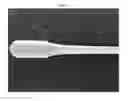 Fig. 02 - Applicators suitable for brachytherapy and methods using same