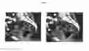 Fig. 08 - Applicators suitable for brachytherapy and methods using same