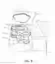 Fig. 11 - AUGMENTED REALITY GLASSES TO HELP DOCTORS VISUALIZE RADIATION PATTERNS AND OVERALL TUMOR SHAPE/SIZE