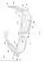 Fig. 12 - AUGMENTED REALITY GLASSES TO HELP DOCTORS VISUALIZE RADIATION PATTERNS AND OVERALL TUMOR SHAPE/SIZE