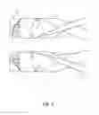 Fig. 05 - Stretch exercise system