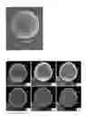 Fig. 02 - Metal particle and articles formed therefrom
