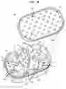 Fig. 10 - Moldable earpiece heating case