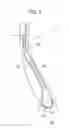Fig. 03 - CONSTRUCTION VEHICLE TIRE