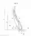 Fig. 04 - CONSTRUCTION VEHICLE TIRE