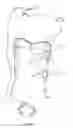 Fig. 06 - METHOD FOR OPERATING A MASSAGE DEVICE OF A SEAT