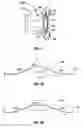 Fig. 06 - Methods and apparatus for resiliently mounting trailer skirt