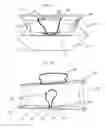Fig. 10 - INTERNAL BAG CLOSURE AND BAG KIT