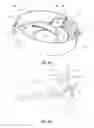 Fig. 07 - Discrete object singulation