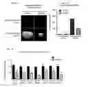 Fig. 11 - KDM4 INHIBITORS