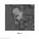 Fig. 07 - SECRETORY TNT CAR CELL IMMUNOTHERAPY