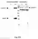 Fig. 32 - Methods for Treating Conditions Associated with MASP-2 Dependent Complement Activation
