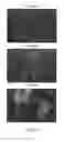 Fig. 06 - Neural cell populations from primate pluripotent stem cells