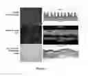 Fig. 03 - Multi-layer airway organoids and methods of making and using the same
