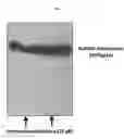 Fig. 02 - NATURAL RUBBER POLYMERASE GENE AND USES THEREOF