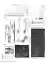 Fig. 02 - ETS factors regulate neural stem cell depletion and gliogenesis in Ras pathway glioma