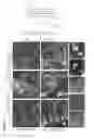 Fig. 07 - ETS factors regulate neural stem cell depletion and gliogenesis in Ras pathway glioma