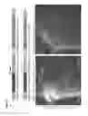 Fig. 15 - ETS factors regulate neural stem cell depletion and gliogenesis in Ras pathway glioma